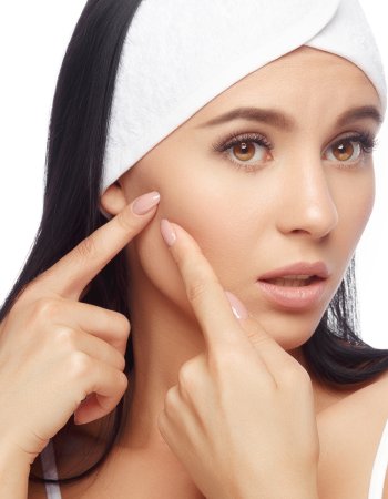 Acne Treatment at Preferred Dermatology