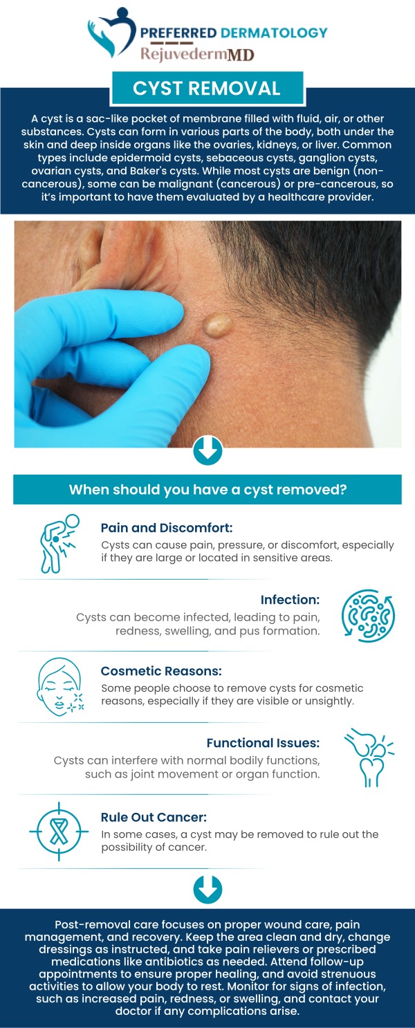At Preferred Dermatology, Dr. Matthew Barrows provides patients with safe and effective ways to remove painful cysts. The clinic focuses on minimizing discomfort and promoting faster healing. Each client receives personalized guidance throughout the treatment process. The team ensures patients feel informed and supported from start to finish. For more information, contact us or book an appointment. We are conveniently located at 3925 S Preston Rd Building 4, Suite 115, Celina, TX 75009.