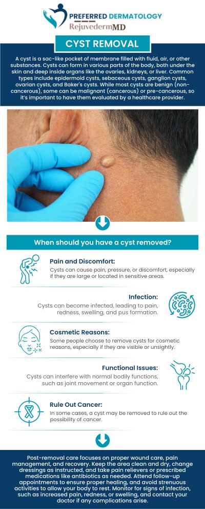 At Preferred Dermatology, Dr. Matthew Barrows provides patients with safe and effective ways to remove painful cysts. The clinic focuses on minimizing discomfort and promoting faster healing. Each client receives personalized guidance throughout the treatment process. The team ensures patients feel informed and supported from start to finish. For more information, contact us or book an appointment. We are conveniently located at 3925 S Preston Rd Building 4, Suite 115, Celina, TX 75009.