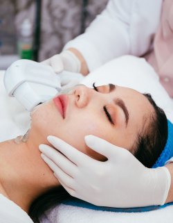 IPL Photofacial Treatment at Preferred Dermatology