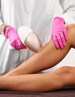 Laser Hair Removal at Preferred Dermatology