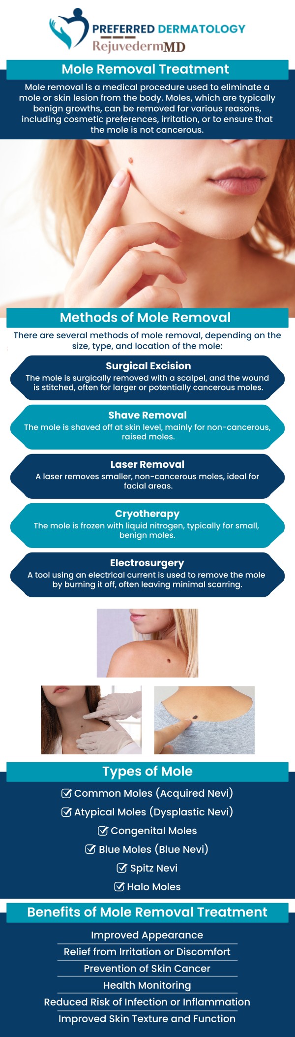 Common questions asked by patients: What is a mole evaluation, and why is it important? When should I consider mole removal? How is a mole removed safely? Are there risks associated with mole removal? What happens after a mole is removed? Can mole evaluation help detect skin cancer early? For more information, contact us or schedule an appointment today. We have convenient locations to serve you in Allen, TX, Anna, TX, Celina, TX, Denton, TX, Forney, TX, Greenville, TX, Lewisville, TX, McKinney, TX, Rockwall, TX, Sherman, TX, Sulphur Springs, TX, and Waxahachie, TX.