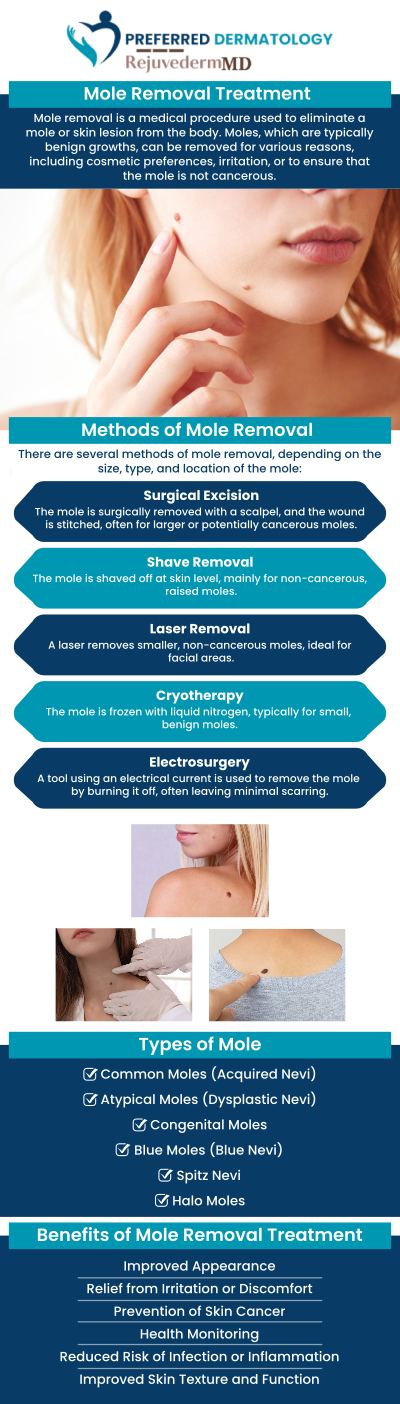 Common questions asked by patients: What is a mole evaluation, and why is it important? When should I consider mole removal? How is a mole removed safely? Are there risks associated with mole removal? What happens after a mole is removed? Can mole evaluation help detect skin cancer early? For more information, contact us or schedule an appointment today. We have convenient locations to serve you in Allen, TX, Anna, TX, Celina, TX, Denton, TX, Forney, TX, Greenville, TX, Lewisville, TX, McKinney, TX, Rockwall, TX, Sherman, TX, Sulphur Springs, TX, and Waxahachie, TX.