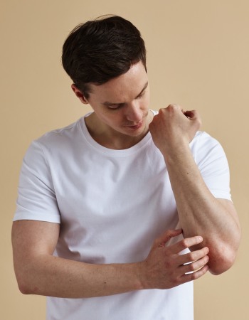 Psoriasis Treatment at Preferred Dermatology